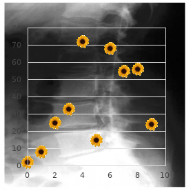 Hypogonadism hypogonadotropic due to mutations in GR hormone