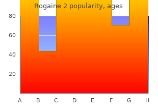 rogaine 2 60  ml low price