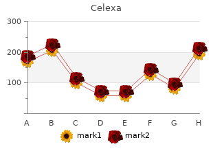 purchase celexa 40mg with mastercard