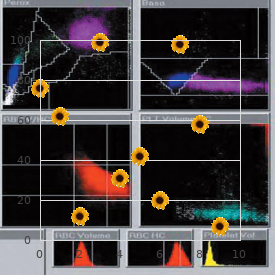 Chromosome 13 duplication