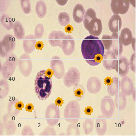 Gonadal dysgenesis