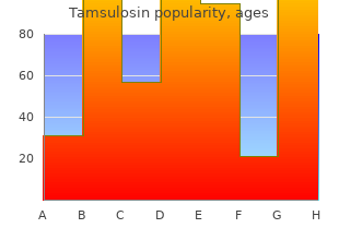 purchase tamsulosin amex