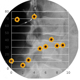 Metatropic dwarfism