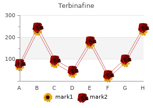 buy 250mg terbinafine visa