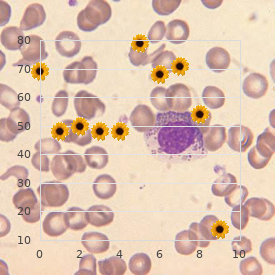 Ischiadic hypoplasia renal dysfunction immunodeficiency